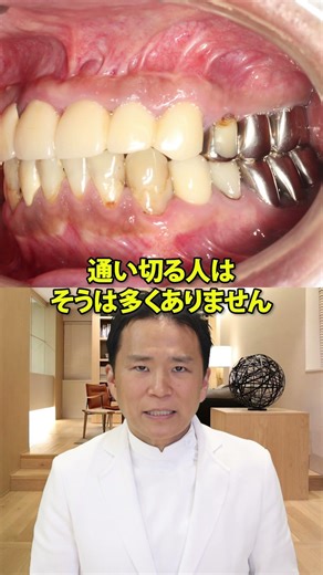 After diligently and seriously visiting the dentist...