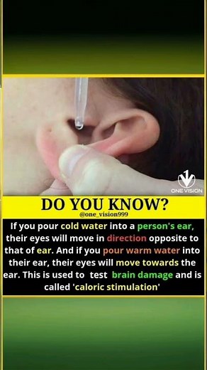 "Unbelievable Brain Test! What Happens When You Pour Water In Your Ear 😳🧠 #PsychologyFacts"