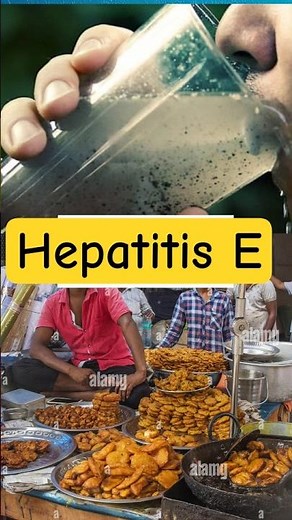 Hepatitis E: The Warning Signs You NEED To Know #shorts #health