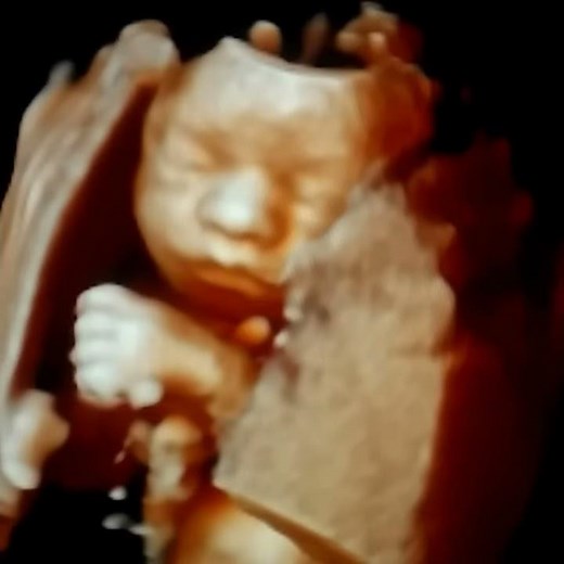 Do babies open their eyes in the womb?