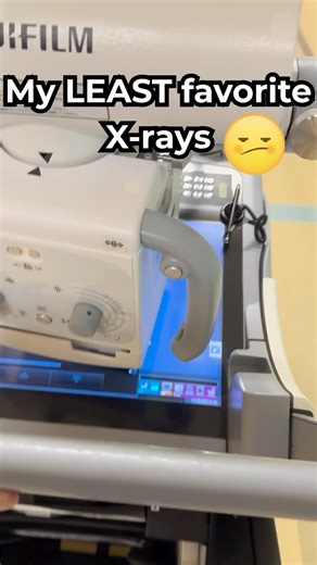 My least favorite X-Ray positions #xray #radiology #healthcare