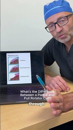 Partial vs Full Rotator Cuff Tear: What Your MRI Actually Shows #shoulderhealth #rotatorc