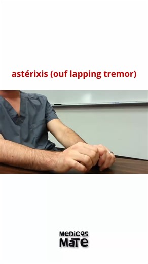Medicosmate on Instagram: "L’astérixis est un signe neurologique qui correspond à une perte brusque et involontaire du tonus musculaire lors d’une posture maintenue. On l’appelle aussi "flapping tremor" car il donne l’impression que les mains "battent" comme des ailes. -Le patient est assis ou debout. -On lui demande de tendre les bras devant lui, poignets en extension, doigts écartés. -On observe les mains : 👉 elles s’abaissent soudainement puis reviennent en position, de façon irrégulière et 