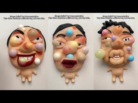 Ultimate Satisfying Pimple Popping Compilation 😳 | Deep Blackhead & Acne Removal