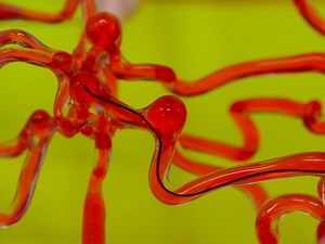 Worm-like robotic thread could improve clot-reducing treatments
