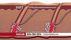 Hair Club TV Spot, 'Hair Loss Doesn't Discriminate'