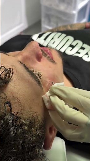 Face Surface Piercing | Healing & Aftercare Tips
