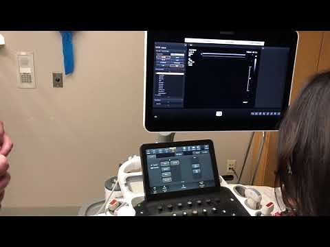 How to perform liver elastography using Philips Epiq ultrasound machine