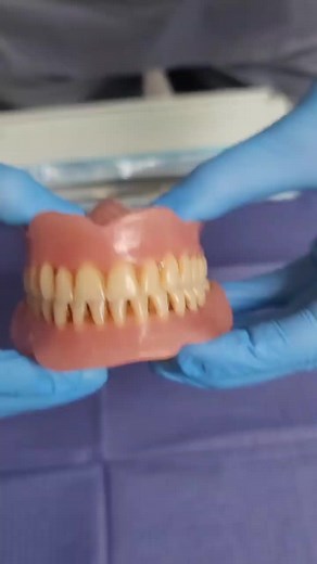 Dental Procedure Insights on Artificial Teeth