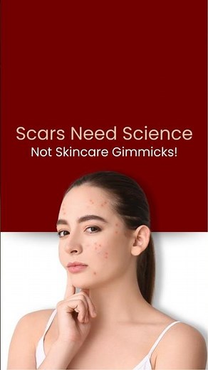 How to Remove Acne Scars and Stretch Marks Permanently? | Best Dermatologist-Recommended Treatments