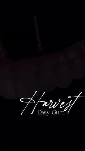 Harvest EasyGum® + Harvest Speed Polish® = Truly finished case (not just done). 🔥