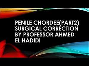 Penile Chordee (part 2) surgical correction by professor Ahmed el hadidi
