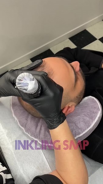 Scalp Micropigmentation