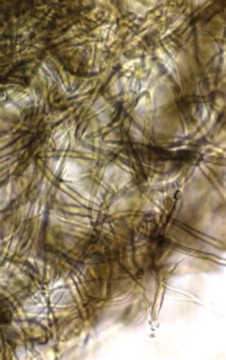 Moldy food up close, can you safely cut around it?