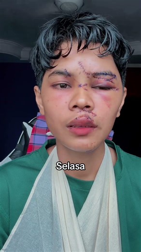 Takdir Allah 🙇🏻‍♀️ #viral #accident #recovery