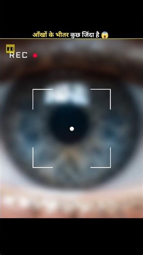 Something Alive Inside Your Eye 😱