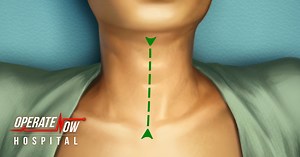 The first and best uncensored hospital simulation 🏥 - now on your iPhone! | Operate Now: Hospital