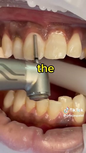 Tejas Patel, DDS on TikTok