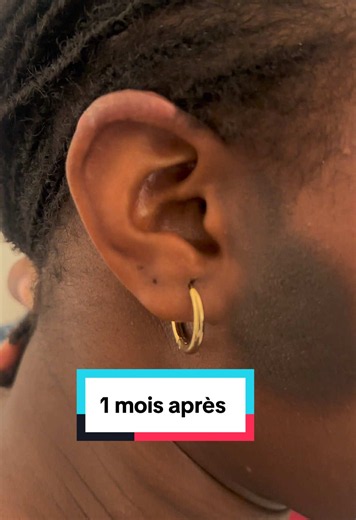 #bienetre