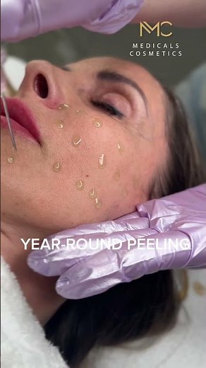 JALUPRO Glow Peel application