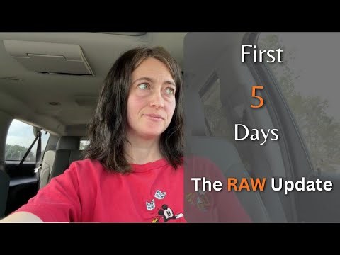 The First 5 Days After Full Mouth Extraction (Graphic gum showing)