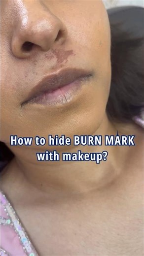 How to hide Burn Mark | Makeup Hack🔥🤗 #makeuptutorial #shorts