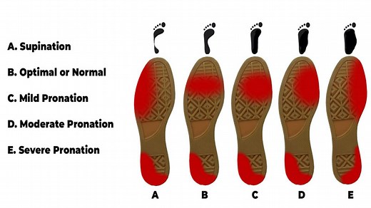 Down and dirty differences between pronation vs supination of foot?