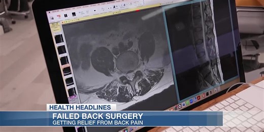 Health Headlines: Fixing failed back surgeries