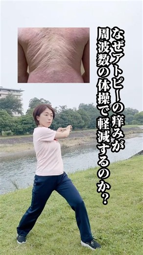 アトピーの痒みを軽減する周波数体操 #美容 #乾燥ケア #アトピー性皮膚炎 #脱ステ