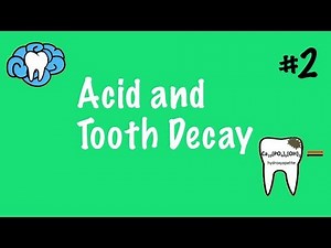 Acid and Tooth Decay