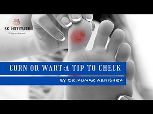 CORN OR WART- A TIP TO CHECK