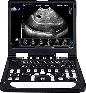 N60 15" LCD Veterinary Ultrasound Machine with PW Function, Carring Bag, Image Video Saving, Case Report Output Print for Cattle Ranch, Horse Farm Animal Pregnancy Check (Rectal Linear Probe)
