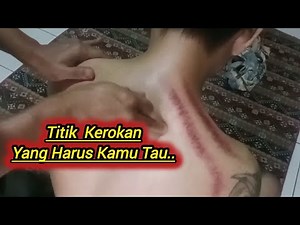 The Correct Way to Scrape with Coins to Get Fit Quickly