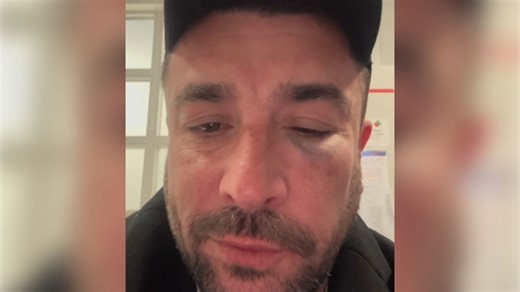 L’humoriste Anthony Joubert agressé dans un train avant un spectacle dans l’Oise