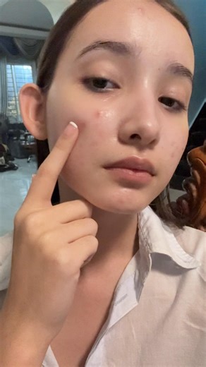 ស្បែកភ្លឺថ្លា ដូចកញ្ចក់ ជាមួយ Glorious Facial Set