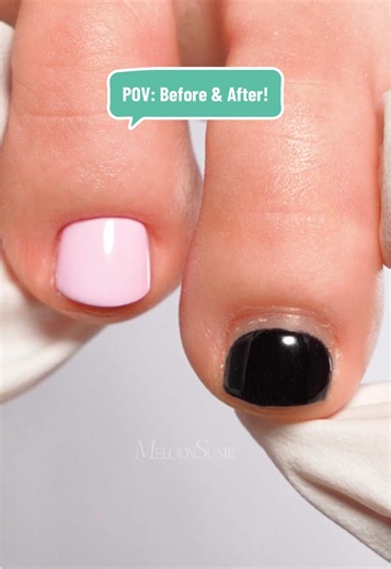 POV: Before & After!😍 Obsessed with that fresh toenail! Summer Sale! All you need is in my shop! #melodysusie #pedicure #pedicuresalon #toenail #nailsalon