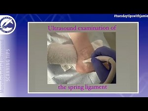 Learn how to locate the Spring Ligament of the Ankle on your MSK Ultrasound exam