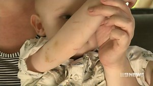 Python attacks toddler in Far North Queensland