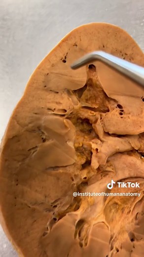 How kidneys work #kidneys #wow #fyp #anatomy | anatomy