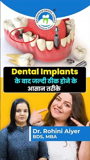 Dental Implant Aftercare: Do’s & Don’ts for Fast Recovery 🦷