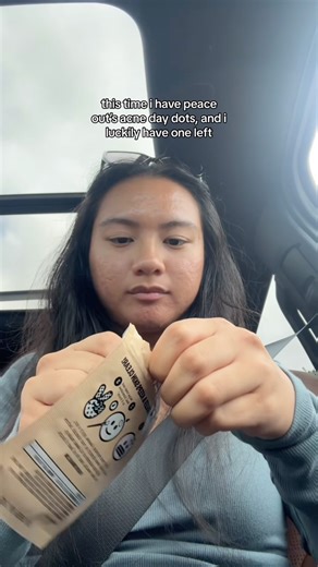 ˗ˏˋ jennilee ashlee ´ˎ˗ on Instagram: "and that’s why you’ll always find pimple patches in my bag, i STAY ready for a moment like this 🙂‍↕️ @peaceoutskincare acne day dot #skincarecreator #skinfluencer #skincareinfluencer #acneskin #acneproneskin #oilyskin #texturedskin #hormonalacne #cysticacne #acneawareness #acnejourney #acnecommunity #contentcreator #newyork"