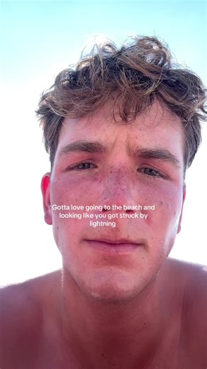 Embrace the Beach Look: Hair and Sun Fun