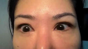 Opsoclonus, opsoclonus myoclonus ataxia syndrome, causes, diagnosis, treatment & prognosis