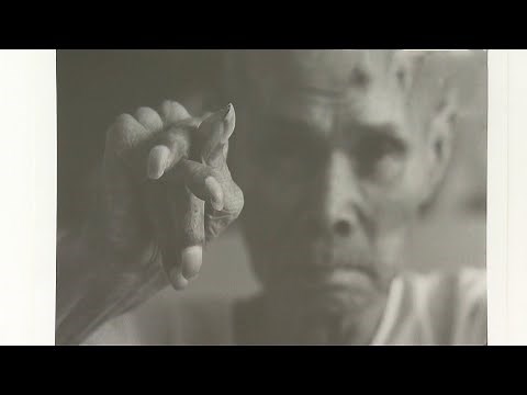 硬直した手　言葉にならない苦しみ　水俣病の歴史や現状辿る