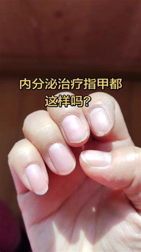 大拇指刚好，食指又伤了，指甲还能好吗？#内分泌 #来曲唑