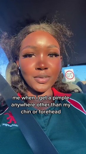 Acne makes you celebrate even the small wins 😅 credits to @