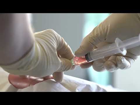 How to use the Cook micropuncture kit