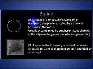 Bleb Bulla Cyst Cavity Pneumatocele