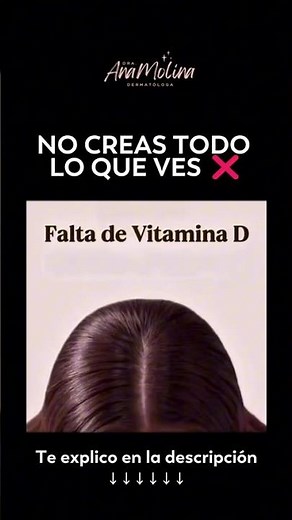 ¿Realmente te falta magnesio en el pelo? El peligro de los falsos diagnósticos. ❌