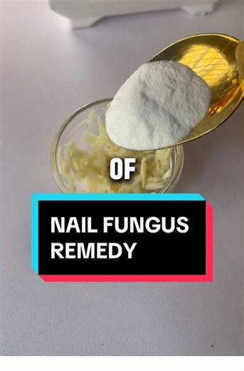 Fast Natural Nail Fungus Remedy Using Garlic